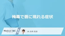 「梅毒」に感染すると「唇」にどんな症状が現れる？進行すると唇はどうなるかも解説！