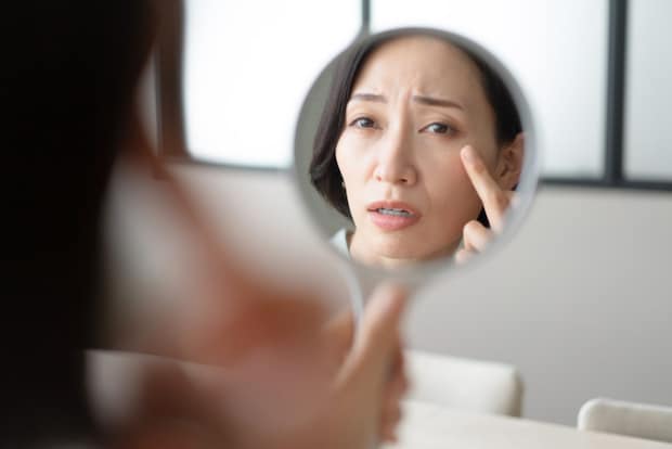 しわの種類と原因を医師が解説！