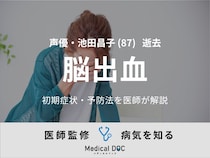 メーテル役で一世を風靡した声優・池田昌子さん（87）逝去 『脳出血』の前兆を医師が徹底解説