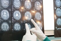 【看護師解説】脳ドックで何が分かる？ 費用相場や検査の流れについて