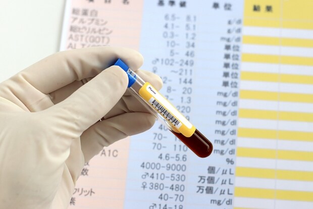 梅毒で唇に症状が出たときの対処法と治療法