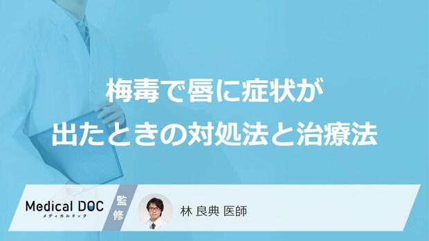 「梅毒で唇に症状」が出たらどんな治療法を行うかご存知ですか？【医師監修】