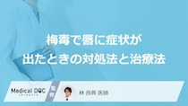 「梅毒で唇に症状」が出たらどんな治療法を行うかご存知ですか？【医師監修】
