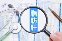 「脂肪肝」になると現れる症状・原因とは？医師が監修！