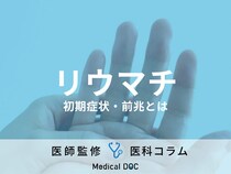 リウマチの初期症状･前兆を医師が解説 関節･手足の違和感はすぐ受診を 早期発見が治療に効果的