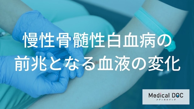 慢性骨髄性白血病の前兆とは？血液の変化と早期発見のポイント【医師解説】
