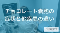 「子宮筋腫」と「チョコレート嚢胞」はどう違う？痛みの質や症状の見分け方【医師解説】