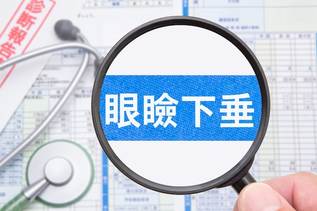 眼瞼下垂の症状と原因