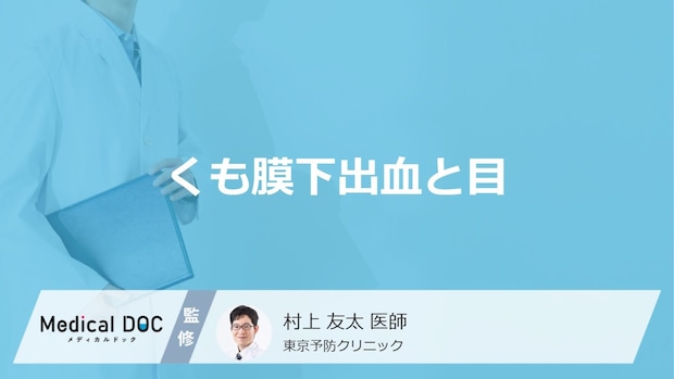 「くも膜下出血」を発症すると「目」にどんな症状が現れるかご存知ですか？【医師解説】