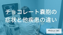 「子宮筋腫」と「チョコレート嚢胞」はどう違う？痛みの質や症状の見分け方【医師解説】