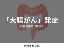 ｢大腸がん｣発症に“口腔内細菌”が産生する物質が関係していた！ 東大病院らが発表