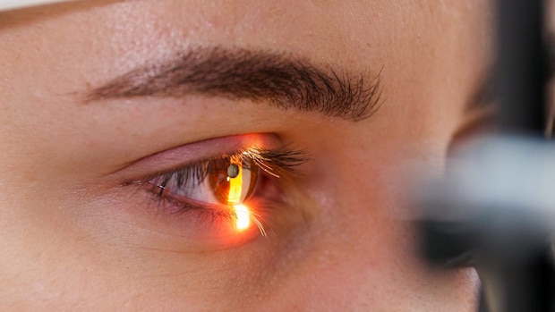 オルソケラトロジー、具体的に何をするか教えて！