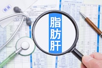 「脂肪肝」になると現れる症状・原因とは？医師が監修！