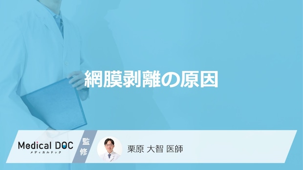 「網膜剥離の原因」はご存知ですか？なりやすい人の特徴や初期症状も解説！【医師監修】