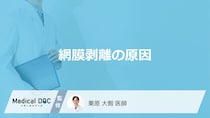 「網膜剥離の原因」はご存知ですか？なりやすい人の特徴や初期症状も解説！【医師監修】
