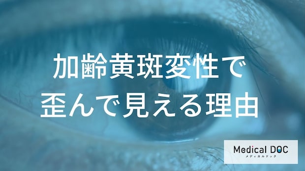 【警告】直線が波打って見えたら失明の危機?50代から急増する「2つの目の異変」
