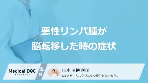 「悪性リンパ腫の脳転移」を疑う”5つの症状”はご存じですか?医師が解説!