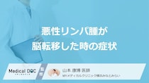 「悪性リンパ腫の脳転移」を疑う”5つの症状”はご存じですか？医師が解説！