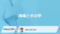 「梅毒」を発症すると「手の甲」にどんな症状が現れるかご存知ですか？【医師監修】