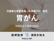 【訃報】松本純・元国家公安委員長 『胃がん』の初期症状を医師が解説