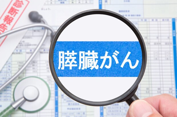 膵臓がんとは？ 初期症状や見逃しがちなサイン