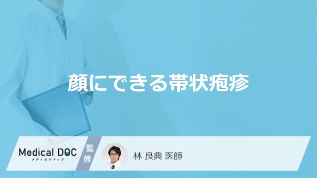 「顔にできる帯状疱疹」の特徴はご存知ですか?症状や跡が残る可能性も解説!