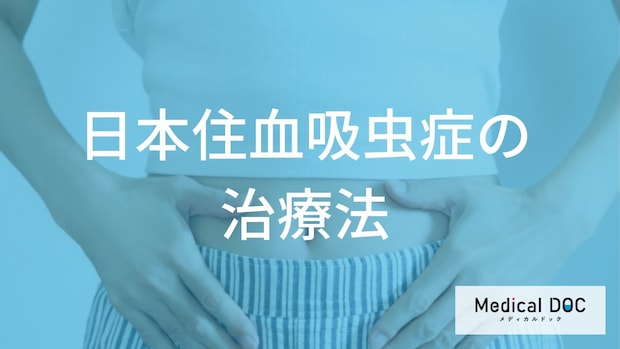 「日本住血吸虫症の治療法」はご存知ですか？【医師監修】