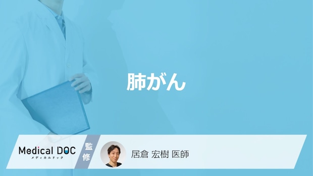 「肺がん」とはどんな病気？ステージ分類についても解説！【医師監修】