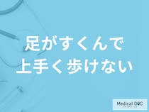 「足がすくんで上手く歩けなくなる」のは”何の初期症状”？他の原因も医師が解説！