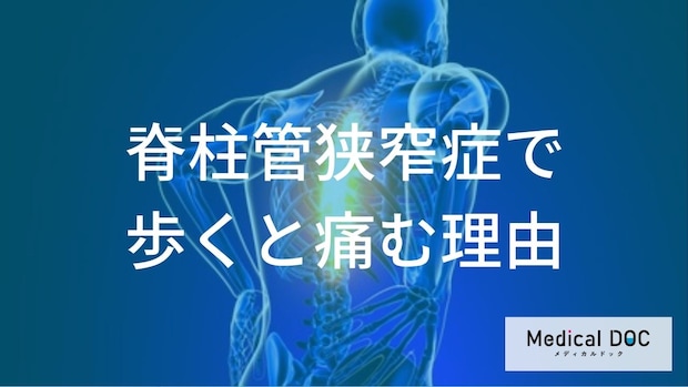 「脊柱管狭窄症」少し休むとまた歩けるのはなぜ？ 不思議な症状の正体を専門家が解説