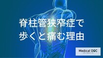 「脊柱管狭窄症」少し休むとまた歩けるのはなぜ？ 不思議な症状の正体を専門家が解説