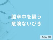 「脳卒中」を疑う「危険ないびき」の特徴はご存知ですか？医師が徹底解説！