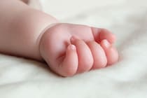 【闘病】自力で排便できない『腸の難病』 生後10カ月で緊急開腹手術、そして人工肛門に…