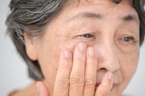 「白内障」で気になる眼内レンズの寿命を眼科医が解説 人生100年時代に向けて上手なレンズ選びを