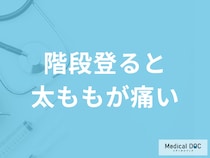 「階段を登ると太ももが痛い」原因はご存知ですか？医師が監修！