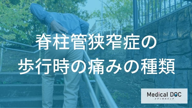 「脊柱管狭窄症」の痛みをご存知ですか? 多様な違和感の感じ方と初期症状