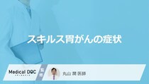 「スキルス胃がんの主な4つの症状」はご存知ですか？医師が徹底解説！