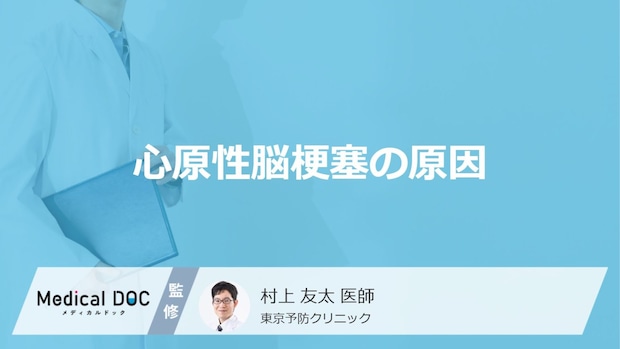 「心原性脳梗塞」を起こす7割の原因は何？なりやすい４つの特徴も医師が解説！