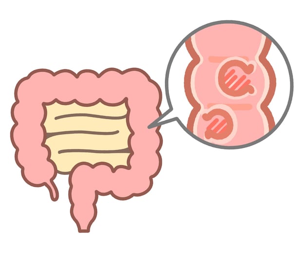なぜ、陰性でも大腸がんが見つかることがあるのか？