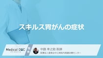 「スキルス胃がんの症状」はご存知ですか？【医師監修】