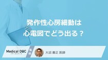 「発作性心房細動」の心電図に現れる“3つの異変”とは？治療法と入院期間を医師が解説！