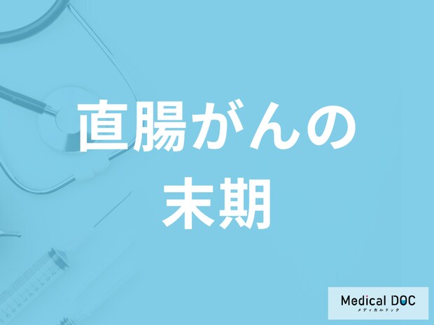 「直腸がんの末期症状」はご存知ですか？ステージ4=末期ではない理由も解説！