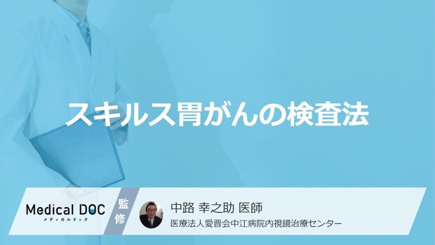 「スキルス胃がんの検査法」はご存知ですか？【医師監修】