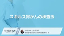 「スキルス胃がんの検査法」はご存知ですか？【医師監修】