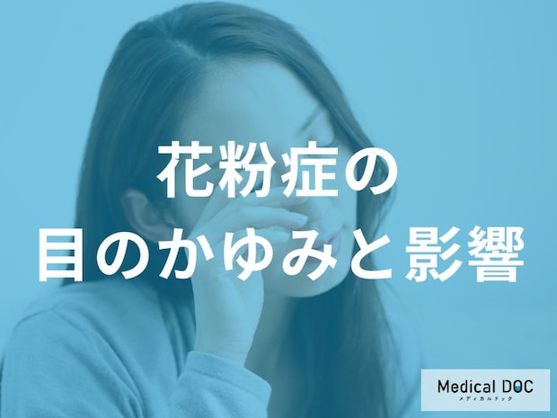 「花粉症の目のかゆみ」の抑え方を医師が解説 “アレルギー性結膜炎”の仕組みと3つの対処法とは