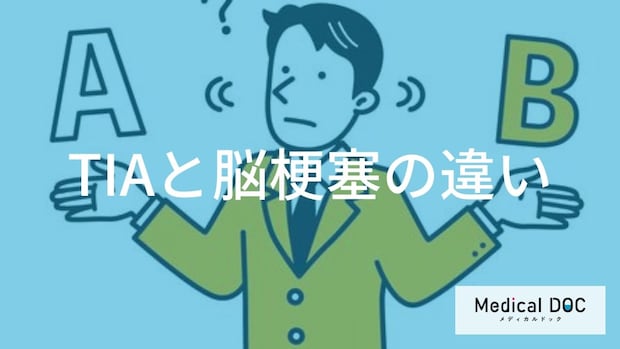 「一過性脳虚血発作（TIA）」と「脳梗塞」の違いをご存じですか？【医師監修】