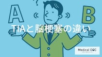 「一過性脳虚血発作（TIA）」と「脳梗塞」の違いをご存じですか？【医師監修】