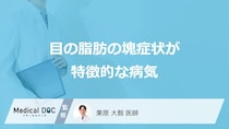 「目の脂肪の塊」は”がん”の恐れも？ものもらいと勘違いしやすい病気も医師が解説！