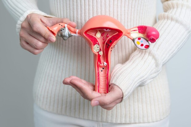 子宮筋腫の概要と治療法