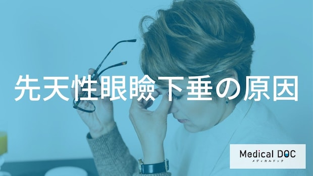 まぶたの筋肉が関係？生まれつきの「先天性眼瞼下垂」が起こる原因と遺伝的要因を解説